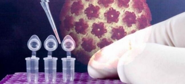 HPV-diagnostiikka digene-testillä