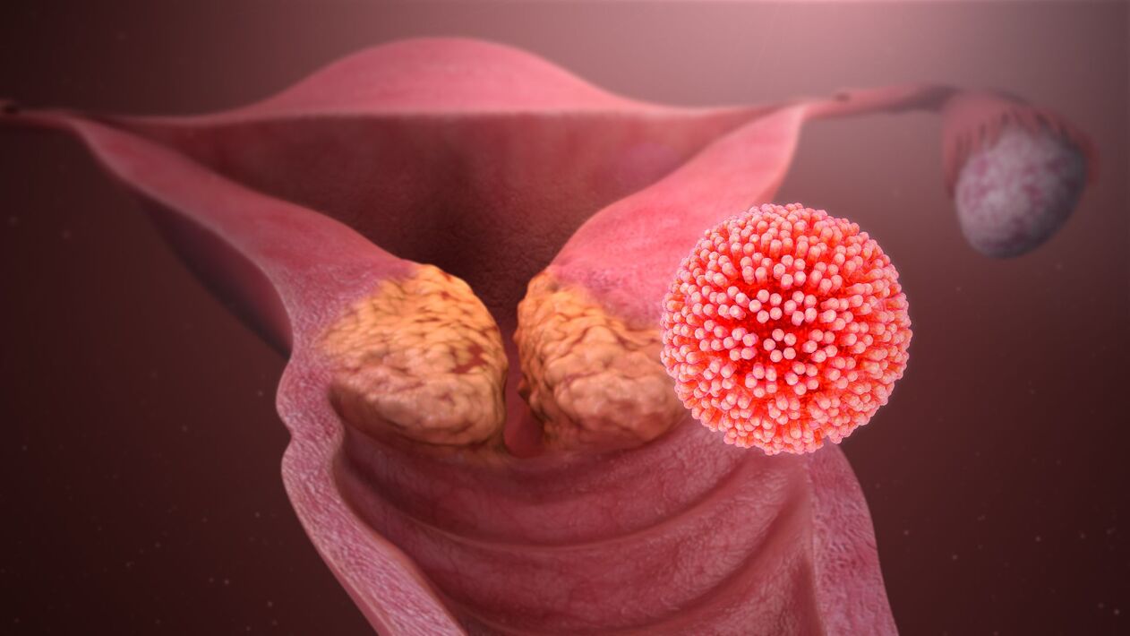 ihmisen papilloomavirus kehossa